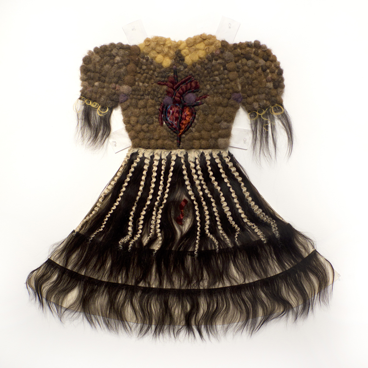 003_Hairy-Hearted_IBS-Dress